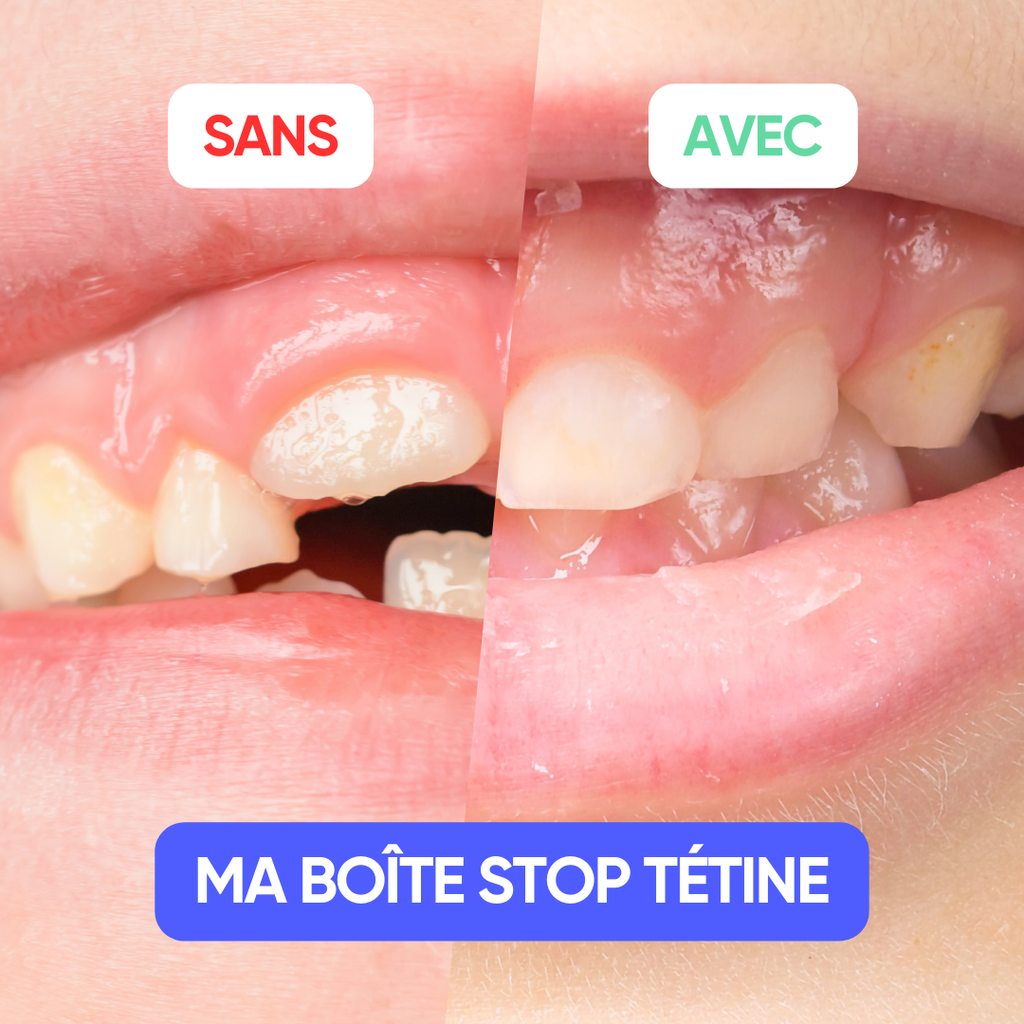 Ma Boîte Stop Tétine