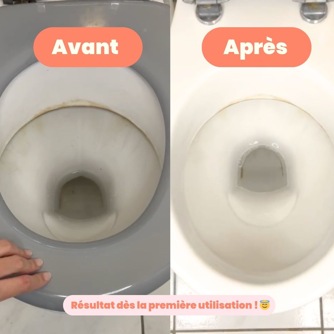 Toilet cleaner (x15)